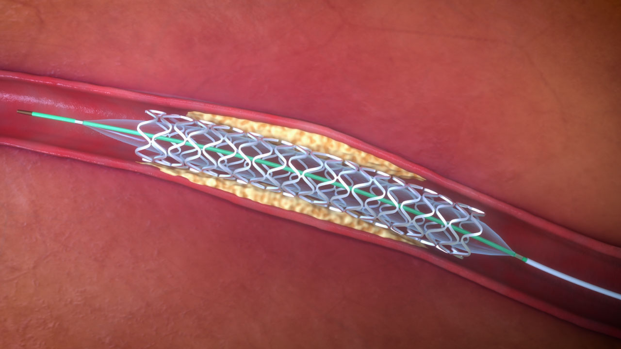 手术机器人3D动画